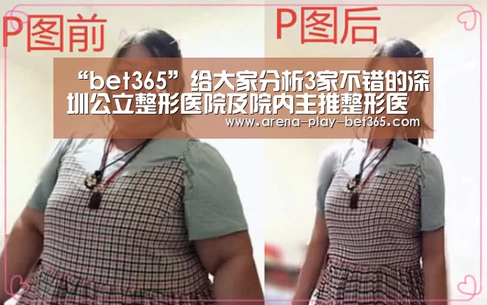 “bet365”给大家分析3家不错的深圳公立整形医院及院内主推整形医生(图1)